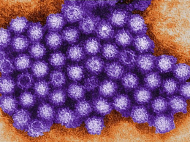 Norovirus 